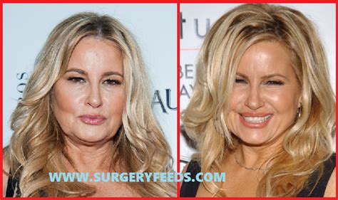 jennifer coolidge before surgery|Jennifer Coolidges Plastic Surgery Left Her Smile Looking